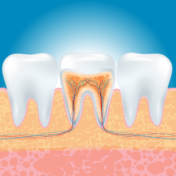 example of a healthy root canal